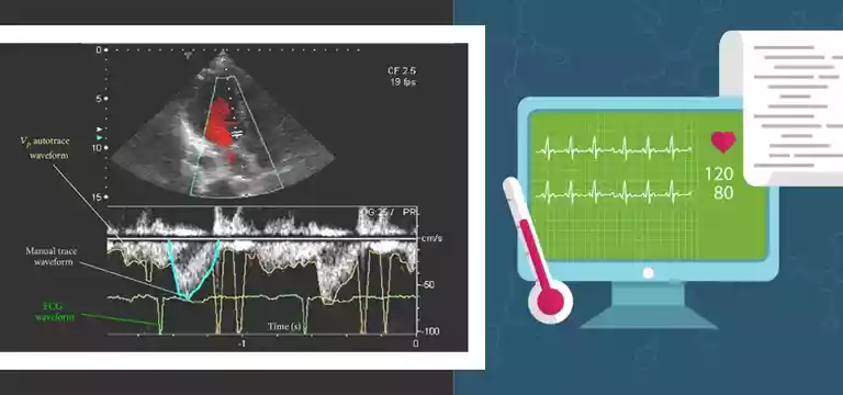 Cardiac Doppler: What is it, Uses, Preparation, Procedure